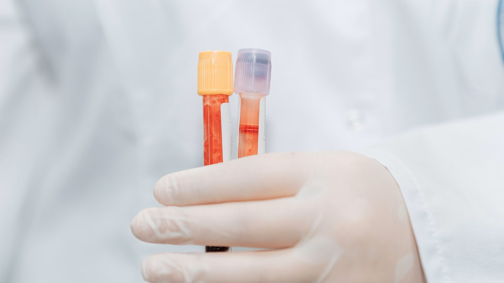 Dutch WGS Reimbursement Transforms Cancer Care Access