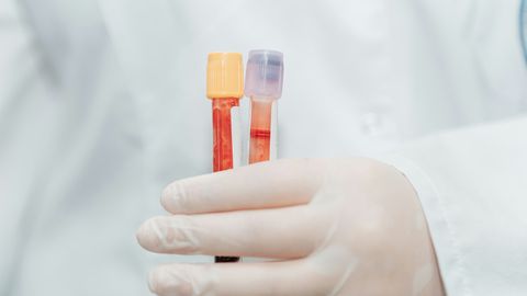 Dutch WGS Reimbursement Transforms Cancer Care Access